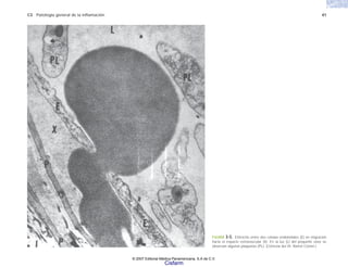 C3 Patología general de la inflamación 41
FIGURA 3-5. Eritrocito entre dos células endoteliales (E) en migración
hacia el espacio estravascular (X). En la luz (L) del pequeño vaso se
observan algunas plaquetas (PL). (Cortesía del Dr. Ramzi Cotran.)
© 2007 Editorial Médica Panamericana, S.A de C.V.
Cisfarm
 
