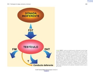 C14 Patología de vejiga, próstata y testículo 443
FIGURA 14-23. Control de la diferenciación embrionaria testicular. Bajo
la influencia de genes localizados en el cromosoma Y, cerca del centró-
mero, aparece el factor de diferenciación testicular (FDT) entre la sexta
y la séptima semanas de gestación. En ausencia de cromosoma Y la
gónada indiferente se diferencia irremisiblemente en ovario; después de
la séptima semana es imposible obtener un testículo por ningún méto-
do experimental. Las células de Sertoli secretan un factor de inhibición
mülleriana (FIM), responsable de la regresión de los conductos de Müller.
Las células de Leydig secretan testosterona (T), hormona fundamental
para la maduración de las estructuras originadas en los conductos de
Wolff (conducto deferente, epidídimo, vesícula seminal, conducto eyacu-
latorio). Un derivado de esta hormona, la dihidrotestosterona (DHT), es
responsable del desarrollo de los genitales masculinos externos, pene y
piel escrotal.
© 2007 Editorial Médica Panamericana, S.A de C.V.
Cisfarm
 
