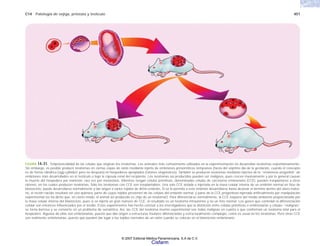 C14 Patología de vejiga, próstata y testículo 451
FIGURA 14-31. Totipotencialidad de las células que originan los teratomas. Los animales más comúnmente utilizados en la experimentación no desarrollan teratomas espontáneamente.
Sin embargo, es posible producir teratomas en ciertas cepas de ratón mediante injerto de embriones presomíticos tempranos (hasta del séptimo día de la gestación, cuando el concepto
es de forma cilíndrica [egg cylinderl, pero no después) en hospederos apropiados (ratones singeneicos). También se producen teratomas mediante injertos de la “eminencia urogenital” de
embriones más desarrollados en el testículo o bajo la cápsula renal del recipiente. Los teratomas así producidos pueden ser malignos, pues crecen masivamente y por lo general causan
la muerte del hospedero por inanición; rara vez por metástasis. Mientras tengan células primitivas, denominadas células de carcinoma embrionario (CCE), pueden trasplantarse a otros
ratones, en los cuales producen teratomas. Sólo los teratomas con CCE son trasplantables. Una sola CCE aislada e injertada en la masa celular interna de un embrión normal en fase de
blastocisto, puede desarrollarse normalmente y dar origen a varios tejidos de dicho embrión. Si se le permite a este embrión desarrollarse hasta alcanzar el término dentro del útero mater-
no, el recién nacido resultará ser una quimera, parte de cuyos tejidos provienen de las células del embrión normal, y parte de la CCE progenitora injertada artificialmente por manipulación
experimental (se ha dicho que, en cierto modo, el animal así producido es ¡hijo de un teratoma!). Para diferenciarse normalmente, la CCE requiere del medio ambiente proporcionado por
la masa celular interna del blastocisto, pues si se injerta un gran número de CCE, el resultado es un teratoma intrauterino y no un feto normal. Los genes que controlan la diferenciación
celular son entonces influenciados por el medio. Estos experimentos han hecho concluir a los investigadores que la distinción entre células primitivas o embrionarias y células “malignas”
se torna borrosa y se convierte en un problema de semántica. Así, las CCE del teratoma murino experimental son todas malignas en cuanto a que conforman un teratoma letal para el
hospedero. Algunas de ellas son embrionarias, puesto que dan origen a estructuras tisulares diferenciadas y estructuralmente complejas, como es usual en los teratomas. Pero otras CCE
son realmente embrionarias, puesto que pueden dar lugar a los tejidos normales de un ratón cuando se colocan en el blastocisto embrionario.
© 2007 Editorial Médica Panamericana, S.A de C.V.
Cisfarm
 