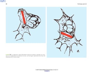 44 Patología general
FIGURA 3-8. La fagocitosis según Metchnikoff. Bacilo del carbunco coloreado con vesu-
vina en el citoplasma de un leucocito de rana. Las dos figuras representan dos fases del
movimiento de la misma célula.
© 2007 Editorial Médica Panamericana, S.A de C.V.
Cisfarm
 