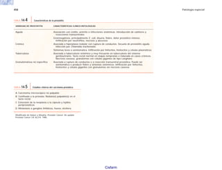 458 Patología especial
VARIEDAD DE PROSTATITIS CARACTERÍSTICAS CLÍNICO-PATOLÓGICAS
Aguda Asociación con cistitis, uretritis o infecciones sistémicas. Introducción de catéteres y
resecciones transuretrales
Gramnegativos, principalmente E. coli, disuria, fiebre, dolor prostático intenso.
Infiltración por neutrófilos, necrosis y abscesos
Crónica Asociada a hiperplasia nodular con ruptura de conductos. Secuela de prostatitis aguda.
Infección por Chlamidia trachomatis.
Síntomas leves o asintomatica. Infiltración por linfocitos, histiocitos y células plasmáticas
Tuberculosa Asociada a tuberculosis sistémica y muy frecuente en tuberculosis del sistema
genitourinario. Tacto rectal normal en etapas tempranas e indurada en casos crónicos.
Necrosis caseosa, granulomas con células gigantes de tipo Langhans
Granulomatosa no específica Asociada a ruptura de conductos o a resección transuretral prostática. Puede ser
asintomática o producir fiebre y síntomas sistémicos. Infiltración por linfocitos,
histiocitos y células gigantes con granulomas sin necrosis caseosa
TABLA 14-4 Características de la prostatitis
A Carcinoma microscópico no palpable
B Confinado a la próstata. Nódulo(s) palpable(s) en el
tacto rectal
C Extensión de la neoplasia a la cápsula y tejidos
periprostáticos
D Metástasis a ganglios linfáticos, hueso, etcétera
Modificado de Huben y Morphy. Prostatic Cancer. An update.
Prostate Cancer CA 36:274. 1986.
TABLA 14-5 Estadios clínicos del carcinoma prostático
Cisfarm
 