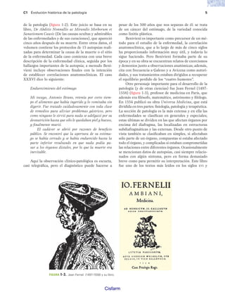 C1 Evolución histórica de la patología 5
de la patología (figura 1-2). Este juicio se basa en su
libro, De Abditis Nonnullis ac Mirandis Morborum et
Sanationum Causis (De las causas ocultas y admirables
de las enfermedades y de sus curaciones), que apareció
cinco años después de su muerte. Entre otros datos, el
volumen contiene los protocolos de 15 autopsias reali-
zadas para determinar la causa de la muerte o el sitio
de la enfermedad. Cada caso comienza con una breve
descripción de la enfermedad clínica, seguida por los
hallazgos importantes de la autopsia; a menudo Beni-
vieni incluye observaciones finales con la intención
de establecer correlaciones anatomoclínicas. El caso
XXXVI dice lo siguiente:
Endurecimiento del estómago
Mi tocayo, Antonio Bruno, retenía por corto tiem-
po el alimento que había ingerido y lo vomitaba sin
digerir. Fue tratado cuidadosamente con toda clase
de remedios para aliviar problemas gástricos, pero
como ninguno le sirvió para nada se adelgazó por su
desnutrición hasta que sólo le quedaban piel y huesos,
y finalmente murió.
El cadáver se abrió por razones de beneficio
público. Se encontró que la apertura de su estóma-
go se había cerrado y se había endurecido hasta la
parte inferior resultando en que nada podía pa-
sar a los órganos distales, por lo que la muerte era
inevitable.
Aquí la observación clínico-patológica es escueta,
casi telegráfica, pero el diagnóstico puede hacerse a
pesar de los 500 años que nos separan de él: se trata
de un cáncer del estómago, de la variedad conocida
como linitis plástica.
Benivieni es importante como precursor de un mé-
todo para el estudio de la enfermedad, la correlación
anatomoclínica, que a lo largo de más de cinco siglos
ha proporcionado información muy útil, y todavía lo
sigue haciendo. Pero Benivieni formaba parte de su
época y en su obra se encuentran relatos de exorcismos
y demonios junto a observaciones anatómicas; además,
cita con frecuencia a Galeno y a Avicena como autori-
dades, y sus tratamientos estaban dirigidos a recuperar
el equilibrio perdido de los “cuatro humores”.
Otro personaje importante para el desarrollo de la
patología (y de otras ciencias) fue Jean Fernel (1497-
1558) (figura 1-3), profesor de medicina en París, que
además era filósofo, matemático, astrónomo y filólogo.
En 1554 publicó su obra Universa Medicina, que está
dividida en tres partes: fisiología, patología y terapéutica.
La sección de patología es la más extensa y en ella las
enfermedades se clasifican en generales y especiales;
estas últimas se dividen en las que afectan órganos por
encima del diafragma, las localizadas en estructuras
subdiafragmáticas y las externas. Desde otro punto de
vista también se clasificaban en simples, si afectaban
sólo parte de un órgano, compuestas si estaba afectado
todo el órgano, y complicadas si estaban comprometidas
las relaciones entre diferentes órganos. Ocasionalmente
se mencionan datos de autopsias, casi siempre relacio-
nados con algún síntoma, pero en forma demasiado
breve como para permitir su interpretación. Este libro
fue uno de los textos más leídos en los siglos XVI y
FIGURA 1-3. Jean Fernel (1497-1558) y su libro.
Patologi a_01_5R.indd 5
Patologi a_01_5R.indd 5 25/4/07 18:51:19
25/4/07 18:51:19
Cisfarm
 