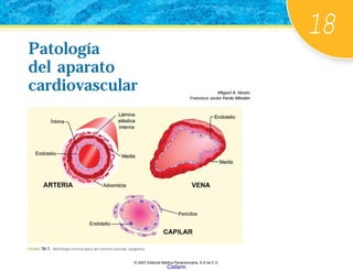18
Miguel A. Idoate
Francisco Javier Pardo Mindán
Patología
del aparato
cardiovascular
Patología
del aparato
cardiovascular
FIGURA 18-1. Morfología microscópica del sistema vascular sanguíneo.
© 2007 Editorial Médica Panamericana, S.A de C.V.
Cisfarm
 