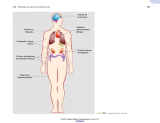 C18 Patología del aparato cardiovascular 585
FIGURA 18-5. Topografía de las vasculitis.
© 2007 Editorial Médica Panamericana, S.A de C.V.
Cisfarm
 