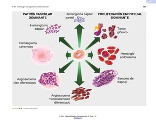 C18 Patología del aparato cardiovascular 589
FIGURA 18-9. Tumores vasculares.
© 2007 Editorial Médica Panamericana, S.A de C.V.
Cisfarm
 