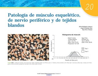 20
Patología de músculo esquelético,
de nervio periférico y de tejidos
blandos
Patología de músculo esquelético,
de nervio periférico y de tejidos
blandos Alicia Rodríguez Velasco
Jorge Fernández Díez
Ruy Pérez Tamayo
FIGURA 20-1. a) Músculo normal, corte transversal, tejido congelado teñido con ATPasa a pH 4.3. Tamaño y forma similares entre fibras tipo 1 (oscuras) y fibras tipo 2 (claras). b) El histo-
grama confirma tamaño y proporción normales entre ambos tipos de fibras.
(b)
5 10 15 20 25 30 35 40 45 50 55 60 65 70 75 80 85 90 95
10
20
30
40
Tipo 1
Tipo 2
0
50
>10
0
Histograma de músculo
Edad 12 años
Triceps derecho
Tipo 1: 51.4%
Diam. Prom. 53.78
Proporción 1/2:1.06
Sexo Fem.
ATPasa: 9.4
Tipo 2: 48.6%
Diam. Prom. 60.65
Número
de
fi
bras
%
Tamaño de fibras (μm)
(a)
© 2007 Editorial Médica Panamericana, S.A de C.V.
Cisfarm
 
