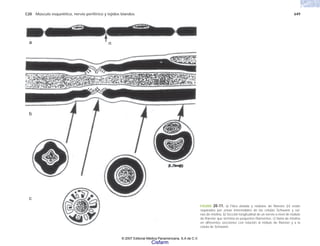 C20 Músculo esquelético, nervio periférico y tejidos blandos 649
FIGURA 20-11. a) Fibra aislada y nódulos de Ranvier (n) están
separados por zonas internodales de las células Schwann y vai-
nas de mielina. b) Sección longitudinal de un nervio a nivel de nódulo
de Ranvier que termina en pequeños filamentos. c) Vaina de mielina
en diferentes secciones con relación al nódulo de Ranvier y a la
célula de Schwann.
a n
b
c
© 2007 Editorial Médica Panamericana, S.A de C.V.
Cisfarm
 