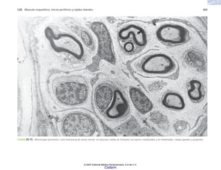 C20 Músculo esquelético, nervio periférico y tejidos blandos 653
FIGURA 20-15. Microscopia electrónica; corte transversal de nervio normal; se observan células de Schwann con axones mielinizados y no mielinizados; células grandes y pequeñas.
© 2007 Editorial Médica Panamericana, S.A de C.V.
Cisfarm
 