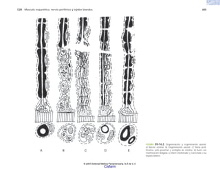 C20 Músculo esquelético, nervio periférico y tejidos blandos 655
A B C D E
FIGURA 20-16.2. Degeneración y regeneración axonal.
a) Nervio normal. b) Degeneración axonal. c) Yema proli-
ferativa, polo proximal y vestigios de mielina. d) Axón con
mielinización delgada. e) Axón mielinizado y conectado a su
órgano blanco.
© 2007 Editorial Médica Panamericana, S.A de C.V.
Cisfarm
 