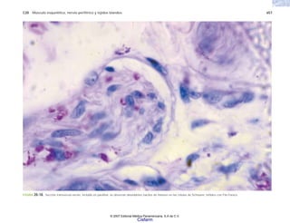 C20 Músculo esquelético, nervio periférico y tejidos blandos 657
FIGURA 20-18. Sección transversal nervio, incluido en parafina; se observan abundantes bacilos de Hansen en las células de Schwann, teñidos con Fite-Faraco.
© 2007 Editorial Médica Panamericana, S.A de C.V.
Cisfarm
 