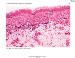 C20 Músculo esquelético, nervio periférico y tejidos blandos 667
FIGURA 20-28. Lipoma subcutáneo; obsérvese la ausencia de cápsula.
© 2007 Editorial Médica Panamericana, S.A de C.V.
Cisfarm
 
