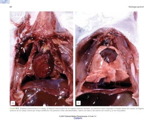 64 Patología general
FIGURA 5-2. Anafilaxia experimental en el cobayo. a) Aspecto macroscópico de los órganos torácicos normales; los pulmones están colapsados y retraídos detrás del corazón. b) Órganos
torácicos de un cobayo muerto por choque anafiláctico; los pulmones están sobredistendidos, cubren casi toda la cara anterior del corazón y se ven muy pálidos.
(a) (b)
© 2007 Editorial Médica Panamericana, S.A de C.V.
Cisfarm
 