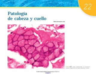 22
Mario Armando Luna
Patología
de cabeza y cuello
Patología
de cabeza y cuello
FIGURA 22-1. Célula multinucleada con inclusiones
nucleares diagnósticas de herpes (prueba de Tzanck).
© 2007 Editorial Médica Panamericana, S.A de C.V.
Cisfarm
 