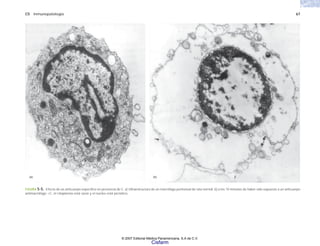 C5 Inmunopatología 67
FIGURA 5-5. Efecto de un anticuerpo específico en presencia de C. a) Ultraestructura de un macrófago peritoneal de rata normal. b) a los 10 minutos de haber sido expuesto a un anticuerpo
antimacrófago +C, el citoplasma está vacío y el núcleo está picnótico.
(b)
(a)
© 2007 Editorial Médica Panamericana, S.A de C.V.
Cisfarm
 