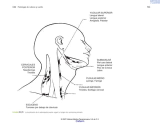 C22 Patología de cabeza y cuello 743
FIGURA 22-31. La localización de la adenopatía puede sugerir el origen de carcinoma primario.
YUGULAR SUPERIOR
Lengua lateral
Lengua posterior
Amigdala, Paladar
SUBMAXILAR
Piel cara lateral
Lengua anterior
Piso de la boca
Labio
YUGULAR MEDIO
Laringe, Faringe
YUGULAR INFERIOR
Tiroides, Esófago cervical
ESCALENO
Tumores por debajo de clavícula
CERVICALES
POSTERIOR
Nasofaringe
Tiroides
© 2007 Editorial Médica Panamericana, S.A de C.V.
Cisfarm
 