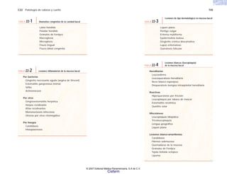 C22 Patología de cabeza y cuello 745
Por bacterias
Gingivitis necrosante aguda (angina de Vincent)
Estomatitis gangrenosa (noma)
Sífilis
Actinomicosis
Por virus
Gingivoestomatitis herpética
Herpes recidivante
Aftas recidivantes
Mononucleosis infecciosa
Úlceras por virus citomegálico
Por hongos
Candidiasis
Histoplasmosis
TABLA 22-2 Lesiones inflamatorias de la mucosa bucal
Liquen plano
Pénfigo vulgar
Eritema multiforme
Epidermolisis bulosa
Gingivitis crónica descamativa
Lupus eritematoso
Queratosis folicular
TABLA 22-3
Lesiones de tipo dermatológico en mucosa bucal
Hereditarias
Leucoedema
Leucoqueratosis hereditaria
Nevo blanco esponjoso
Disqueratosis benigna intraepitelial hereditaria
Reactivas
Hiperqueratosis por fricción
Leucoplaquia por tabaco de mascar
Estomatitis nicotínica
Queilitis solar
Misceláneas
Leucoplaquia idiopática
Tricoleucoplaquia
Lengua geográfica
Liquen plano
Lesiones blanco-amarillentas
Candidiasis
Fibrosis submucosa
Quemaduras de la mucosa
Gránulos de Fordyce
Tejido linfoide ectópico
Lipoma
TABLA 22-4
Lesiones blancas (leucoplaquia)
de la mucosa bucal
Labio hendido
Paladar hendido
Gránulos de Fordyce
Macroglosia
Microglosia
Fisura lingual
Fisura labial congénita
TABLA 22-1 Anomalías congénitas de la cavidad bucal
© 2007 Editorial Médica Panamericana, S.A de C.V.
Cisfarm
 