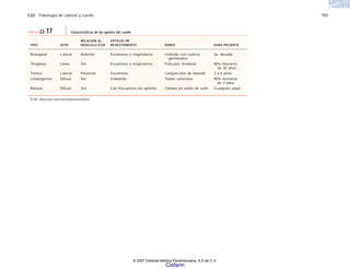 C22 Patología de cabeza y cuello 751
RELACIÓN AL EPITELIO DE
TIPO SITIO MÚSCULO ECM REVESTIMIENTO PARED EDAD PACIENTE
Branquial Lateral Anterior Escamoso o respiratorio Linfoide con centros 3a. década
germinales
Tirogloso Línea Sin Escamoso o respiratorio Folículos tiroideos 90% menores
de 30 años
Tímico Lateral Posterior Escamoso Corpúsculos de Hassall 3 a 6 años
Linfangioma Difuso Sin Endotelio Tejido conectivo 90% menores
de 3 años
Ránula Difuso Sin Con frecuencia sin epitelio Células en anillo de sello Cualquier edad
ECM: Músculo esternocleidomastoideo.
TABLA 22-17 Características de los quistes del cuello
© 2007 Editorial Médica Panamericana, S.A de C.V.
Cisfarm
 