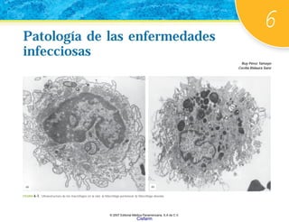 6
Patología de las enfermedades
infecciosas
Patología de las enfermedades
infecciosas
Ruy Pérez Tamayo
Cecilia Ridaura Sanz
FIGURA 6-1. Ultraestructura de los macrófagos en la rata. a) Macrófago peritoneal. b) Macrófago alveolar.
(b)
(a)
© 2007 Editorial Médica Panamericana, S.A de C.V.
Cisfarm
 