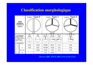 Classification morphologique




          Sievers HH. JTCS 2007;133:1226-1233.
 