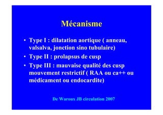 Mécanisme
• Type I : dilatation aortique ( anneau,
  valsalva, jonction sino tubulaire)
• Type II : prolapsus de cusp
• Type III : mauvaise qualité des cusp
  mouvement restrictif ( RAA ou ca++ ou
  médicament ou endocardite)

          De Waroux JB circulation 2007
 