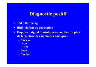 Diagnostic positif
• TM : fluttering
• Bidi : défaut de coaptation
• Doppler : signal diastolique en arrière du plan
  de fermeture des sigmoïdes aortiques
   – Couleur
      • 2D
      • TM
   – Pulsé
   – Continu
 