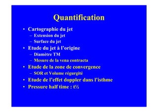 Quantification
• Cartographie du jet
   – Extension du jet
   – Surface du jet
• Etude du jet à l’origine
   – Diamètre TM
   – Mesure de la vena contracta
• Etude de la zone de convergence
   – SOR et Volume régurgité
• Etude de l’effet doppler dans l’isthme
• Pressure half time : t½
 