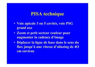 PISA technique
• Voie apicale 3 ou 5 cavités, voie PSG
  grand axe
• Zoom et petit secteur couleur pour
  augmenter la cadence d’image
• Déplacer la ligne de base dans le sens du
  flux jusqu’à une vitesse d’aliazing de 4O
  cm environ
 