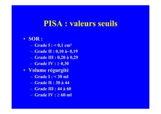 PISA : valeurs seuils
• SOR :
  –   Grade I : < 0,1 cm²
  –   Grade II : 0,10 à- 0,19
  –   Grade III : 0,20 à 0,29
  –   Grade IV : ≥ 0,30
• Volume régurgité
  –   Grade I : < 30 ml
  –   Grade II : 30 à 44
  –   Grade III : 44 à 60
  –   Grade IV : ≥ 60 ml
 