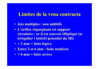 Limites de la vena contracta
• Jets multiples : non additifs
• L’orifice régurgitant est supposé
  circulaire : or il est souvent élliptique ou
  irrégulier ( intérêt potentiel du 3D)
• < 3 mm = fuite légère
• Entre 3 et 6 mm : fuite modérée
• > 6 mm = fuite sévère
 
