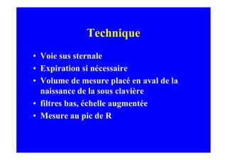 Technique
• Voie sus sternale
• Expiration si nécessaire
• Volume de mesure placé en aval de la
  naissance de la sous clavière
• filtres bas, échelle augmentée
• Mesure au pic de R
 