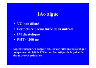 IAo aigue
•   VG non dilaté
•   Fermeture prématurée de la mitrale
•   IM diastolique
•   PHT < 200 ms

Aspect trompeur en doppler couleur car fuite protodiastolique
 uniquement du fait de l’élévation fantastique de la ptd VG et
risque de sous estimation
 