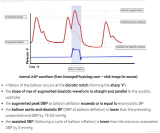 Intraaortic Baloon Counter Pulsation
Dr.Sherif Badrawy
 