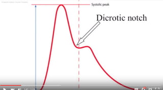 Intraaortic Baloon Counter Pulsation
Dr.Sherif Badrawy
 