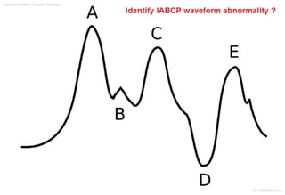 Intraaortic Baloon Counter Pulsation
Dr.Sherif Badrawy
 
