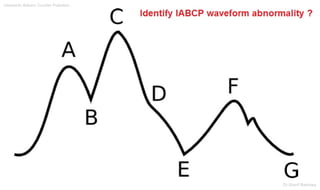 Intraaortic Baloon Counter Pulsation
Dr.Sherif Badrawy
 