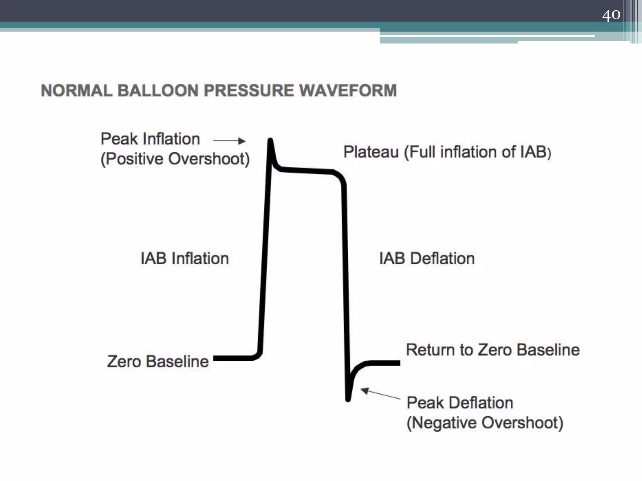 Iab Inflation IABP | PPTX