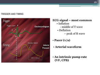 26
ECG signal – most common
• Inflation
- middle of T wave
• Deflation
– peak of R wave
• Pacer (v/a)
• Arterial waveform
• An intrinsic pump rate
(VF, CPB)
 