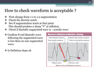 35
How to check waveform is acceptable ?
 First change from 1:1 to 1:2 augmentation
 Check the dicrotic notch
 See if augmentation starts at that point
This should produce a sharp “V” at inflation.
 Check if diastolic augmented wave is › systolic wave
 Confirm if end diastolic wave
following the augmented wave
is less than an non augmented
wave.
 Is Deflation slope ok
 