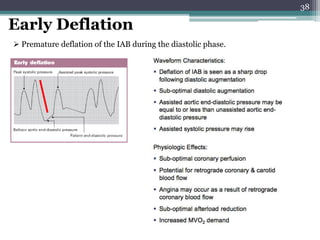 38
Early Deflation
 Premature deflation of the IAB during the diastolic phase.
 