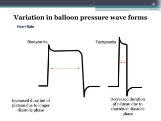 41
Variation in balloon pressure wave forms
Increased duration of
plateau due to longer
diastolic phase
Decreased duration
of plateau due to
shortened diastolic
phase
 