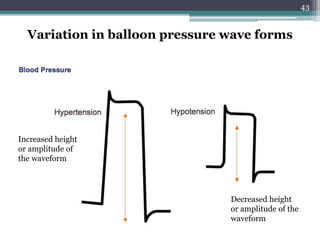 43
Variation in balloon pressure wave forms
Increased height
or amplitude of
the waveform
Decreased height
or amplitude of the
waveform
 