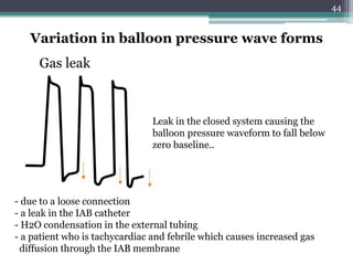 44
Variation in balloon pressure wave forms
Gas leak
Leak in the closed system causing the
balloon pressure waveform to fall below
zero baseline..
- due to a loose connection
- a leak in the IAB catheter
- H2O condensation in the external tubing
- a patient who is tachycardiac and febrile which causes increased gas
diffusion through the IAB membrane
 