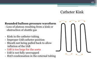 45
Catheter Kink
Rounded balloon pressure waveform
- Loss of plateau resulting from a kink or
obstruction of shuttle gas
- Kink in the catheter tubing
- Improper IAB catheter position
- Sheath not being pulled back to allow
inflation of the IAB
- IAB is too large for the aorta
- IAB is not fully unwrapped
- H2O condensation in the external tubing
 