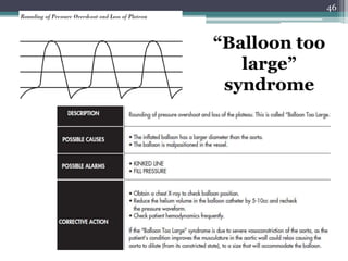 46
“Balloon too
large”
syndrome
 