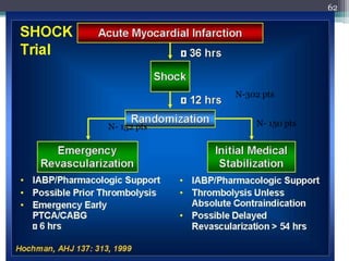62
N-302 pts
N- 152 pts N- 150 pts
 