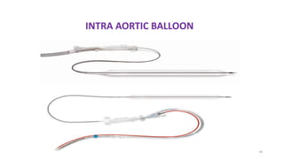 18
INTRA AORTIC BALLOON
 