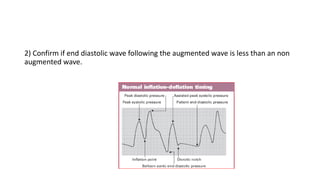2) Confirm if end diastolic wave following the augmented wave is less than an non
augmented wave.
 