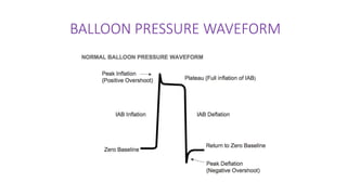 BALLOON PRESSURE WAVEFORM
 