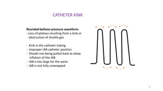 63
CATHETER KINK
Rounded balloon pressure waveform
- Loss of plateau resulting from a kink or
obstruction of shuttle gas
- Kink in the catheter tubing
- Improper IAB catheter position
- Sheath not being pulled back to allow
inflation of the IAB
- IAB is too large for the aorta
- IAB is not fully unwrapped
 