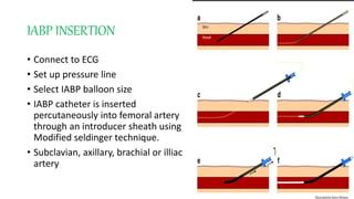 IABP INSERTION
• Connect to ECG
• Set up pressure line
• Select IABP balloon size
• IABP catheter is inserted
percutaneously into femoral artery
through an introducer sheath using
Modified seldinger technique.
• Subclavian, axillary, brachial or illiac
artery
 